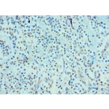 Immunohistochemistry - CRY2 Polyclonal Antibody from Signalway Antibody (42656) - Antibodies.com