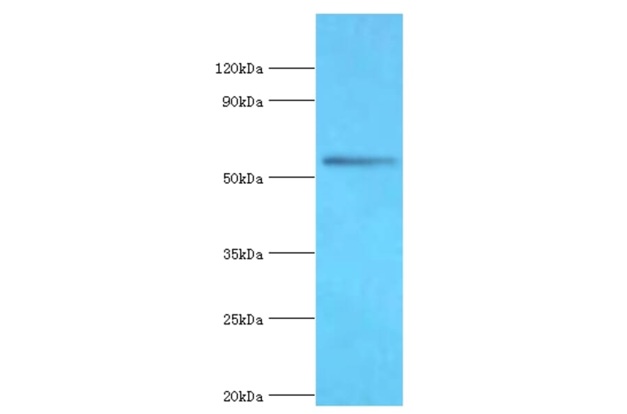 BRD9 Polyclonal Antibody from Signalway Antibody (42690) - Antibodies.com