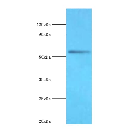 BRD9 Polyclonal Antibody from Signalway Antibody (42690) - Antibodies.com