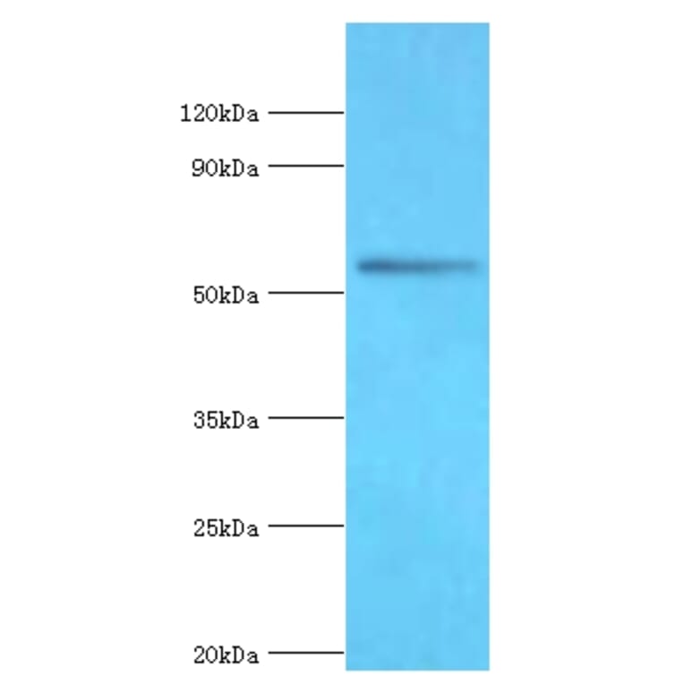 BRD9 Polyclonal Antibody from Signalway Antibody (42690) - Antibodies.com