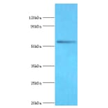 BRD9 Polyclonal Antibody from Signalway Antibody (42690) - Antibodies.com