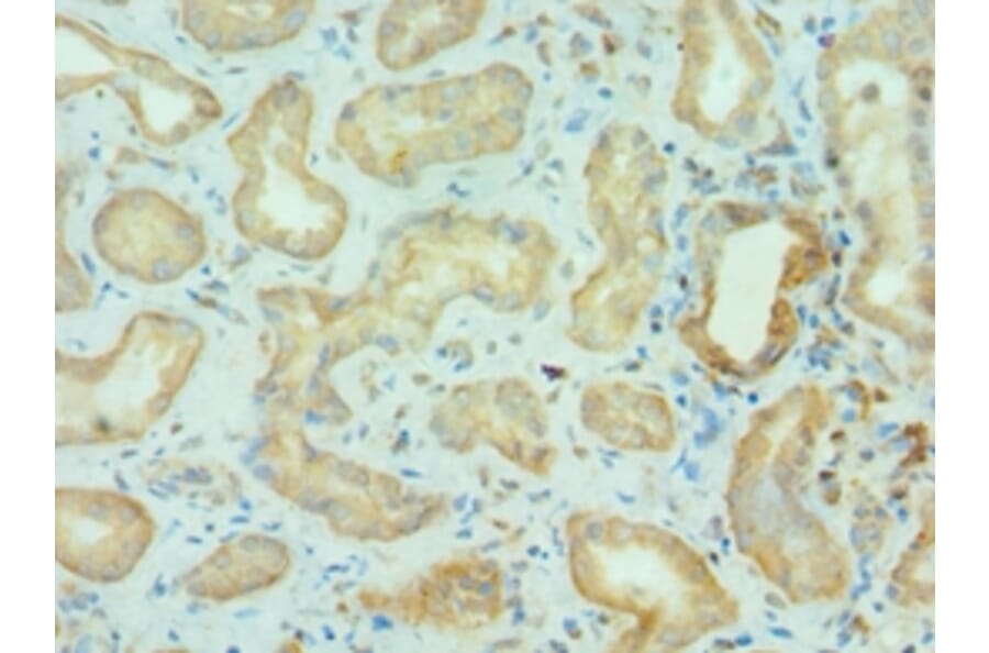 Immunohistochemistry - BRD9 Polyclonal Antibody from Signalway Antibody (42690) - Antibodies.com