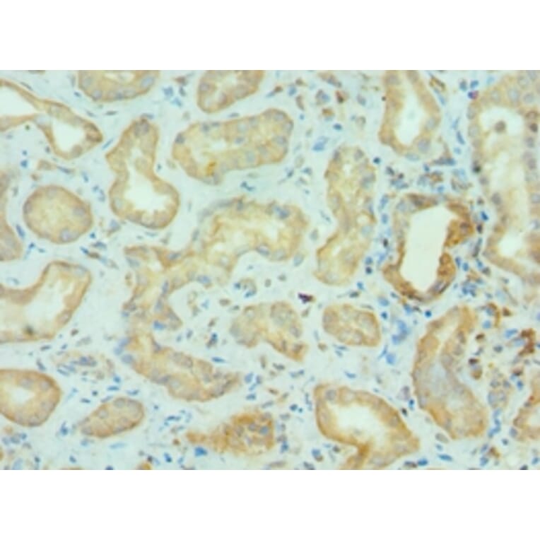 Immunohistochemistry - BRD9 Polyclonal Antibody from Signalway Antibody (42690) - Antibodies.com