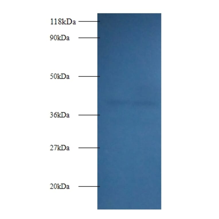 Fructose-bisphosphate aldolase A Polyclonal Antibody from Signalway Antibody (42051) - Antibodies.com