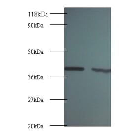 Rho GDP-dissociation inhibitor 1 Polyclonal Antibody from Signalway Antibody (42055) - Antibodies.com