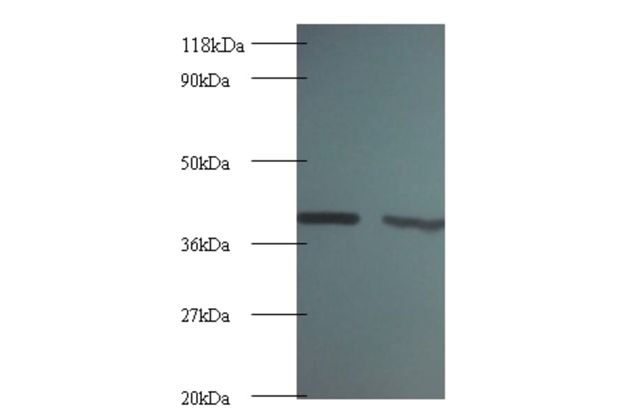 Rho GDP-dissociation inhibitor 1 Polyclonal Antibody from Signalway Antibody (42055) - Antibodies.com