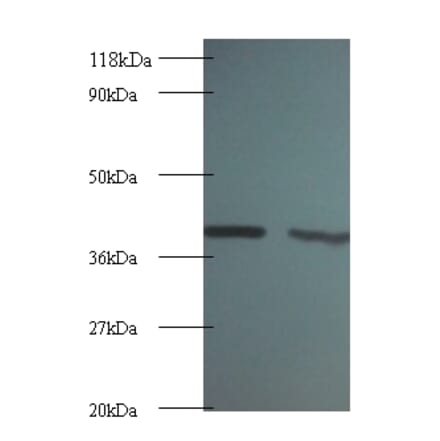 Rho GDP-dissociation inhibitor 1 Polyclonal Antibody from Signalway Antibody (42055) - Antibodies.com