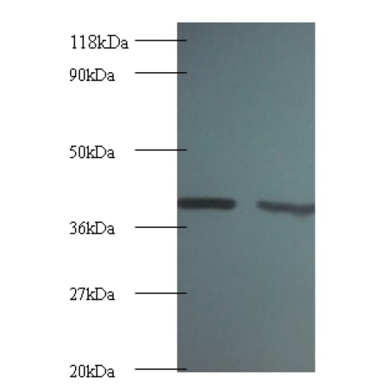 Rho GDP-dissociation inhibitor 1 Polyclonal Antibody from Signalway Antibody (42055) - Antibodies.com