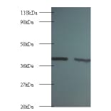 Rho GDP-dissociation inhibitor 1 Polyclonal Antibody from Signalway Antibody (42055) - Antibodies.com