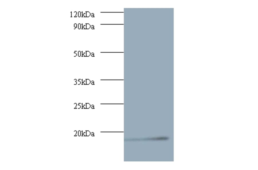 V-type proton ATPase subunit G 1 Polyclonal Antibody from Signalway Antibody (42060) - Antibodies.com