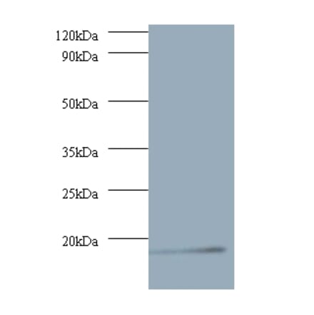 V-type proton ATPase subunit G 1 Polyclonal Antibody from Signalway Antibody (42060) - Antibodies.com