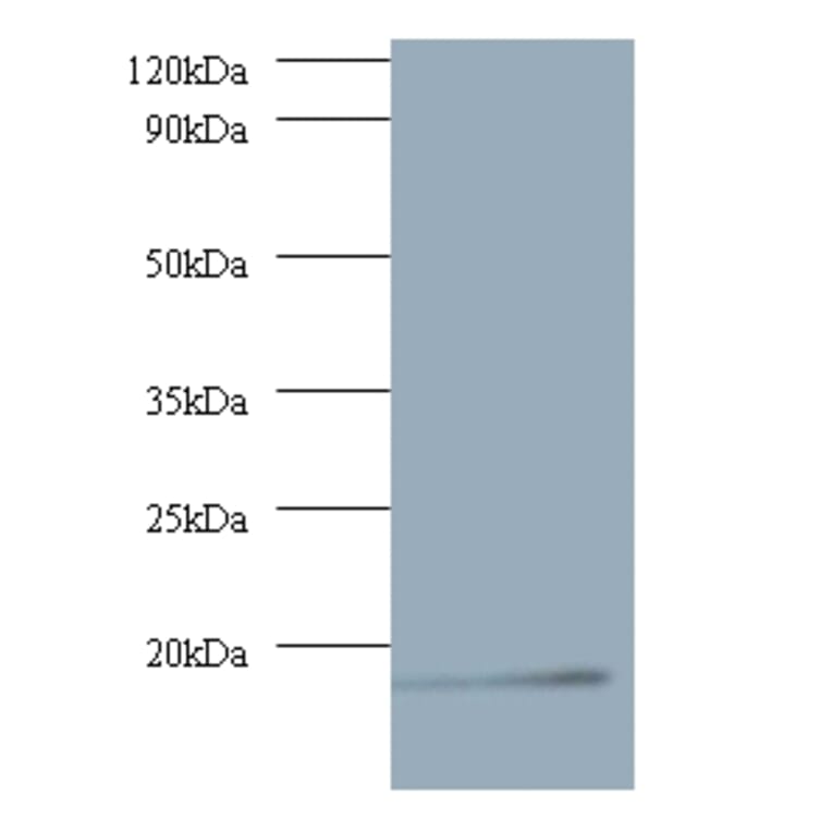 V-type proton ATPase subunit G 1 Polyclonal Antibody from Signalway Antibody (42060) - Antibodies.com