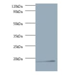 V-type proton ATPase subunit G 1 Polyclonal Antibody from Signalway Antibody (42060) - Antibodies.com