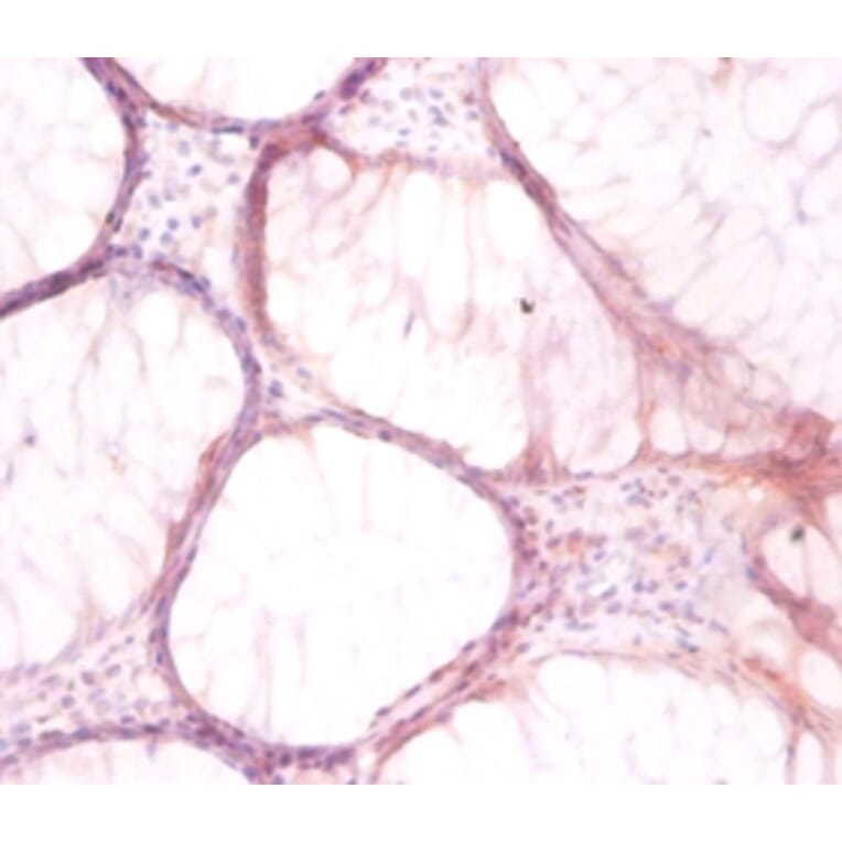 Immunohistochemistry - V-type proton ATPase subunit G 1 Polyclonal Antibody from Signalway Antibody (42060)