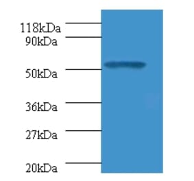 Glucagon-like peptide 1 receptor Polyclonal Antibody from Signalway Antibody (42184) - Antibodies.com