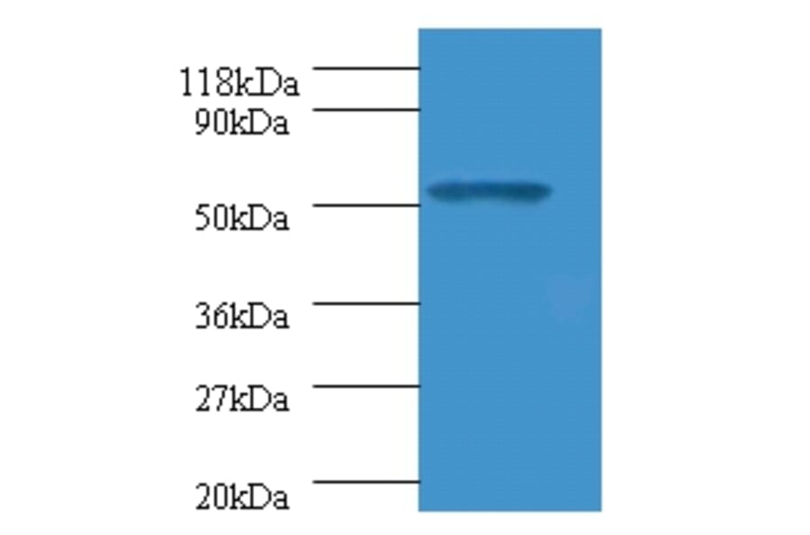 Glucagon-like peptide 1 receptor Polyclonal Antibody from Signalway Antibody (42184) - Antibodies.com