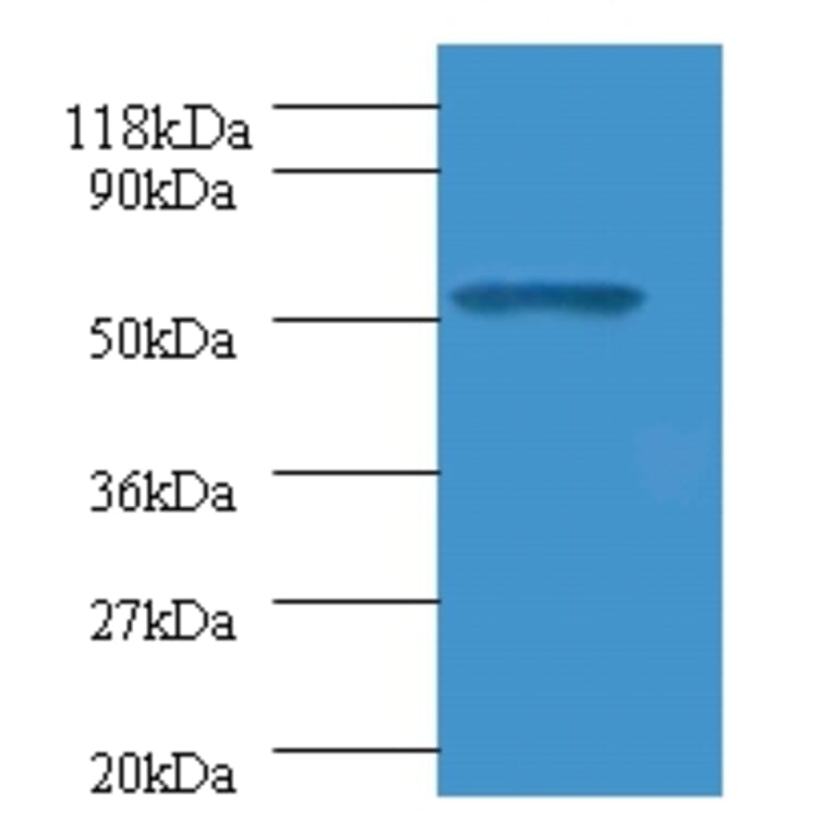 Glucagon-like peptide 1 receptor Polyclonal Antibody from Signalway Antibody (42184) - Antibodies.com