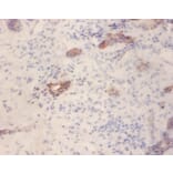 Immunohistochemistry - Glucagon-like peptide 1 receptor Polyclonal Antibody from Signalway Antibody (42184)