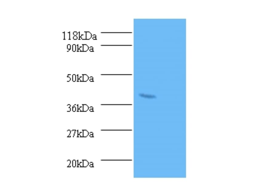 Serum paraoxonase/arylesterase 1 Polyclonal Antibody from Signalway Antibody (42298) - Antibodies.com