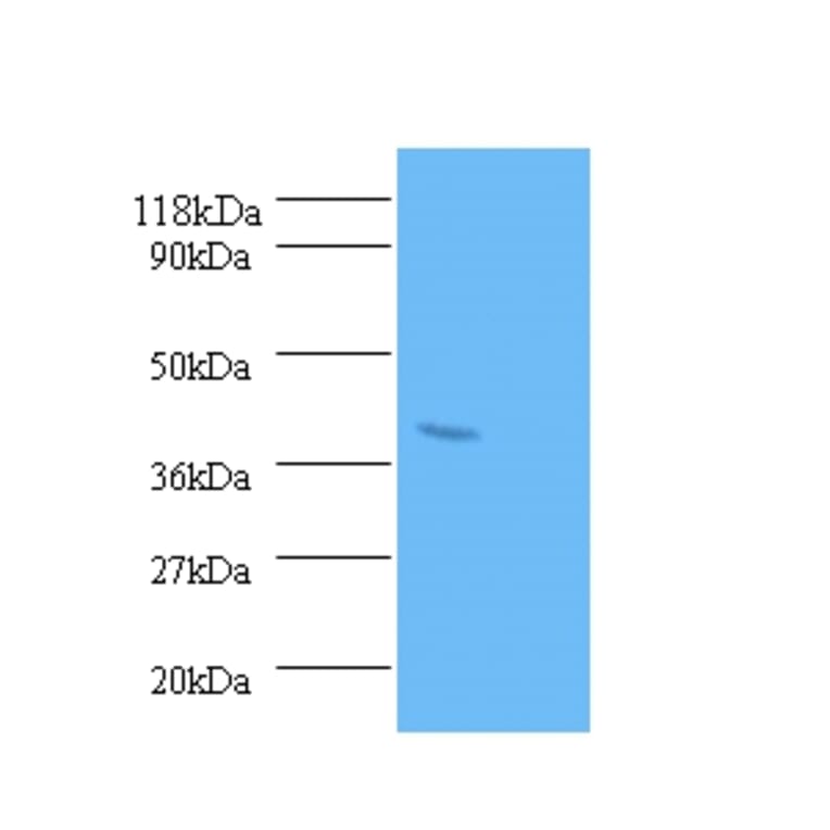 Serum paraoxonase/arylesterase 1 Polyclonal Antibody from Signalway Antibody (42298) - Antibodies.com