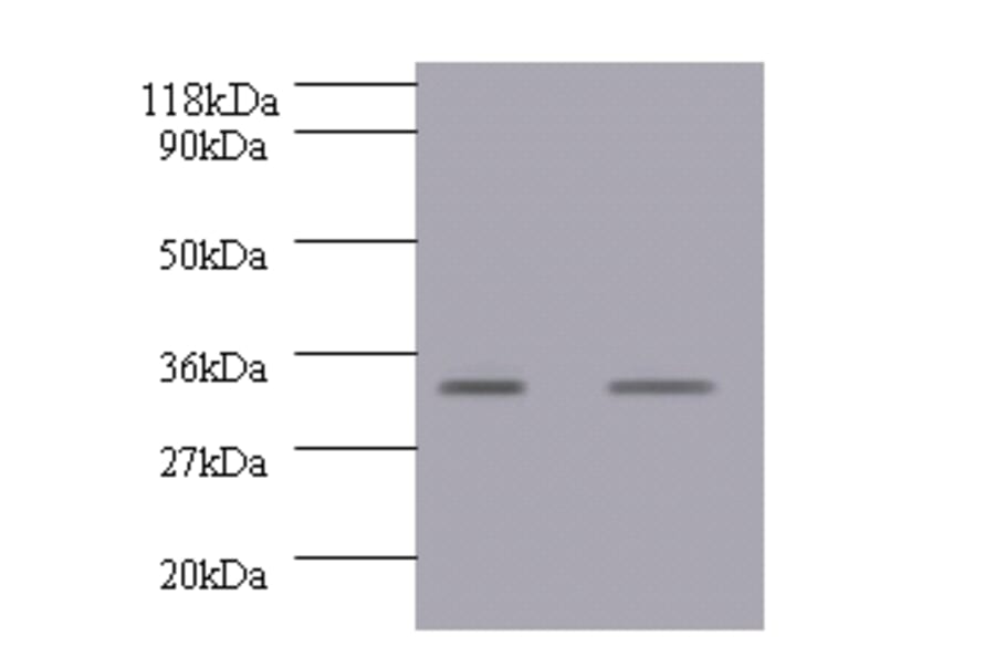 Growth/differentiation factor 15 Polyclonal Antibody from Signalway Antibody (42518) - Antibodies.com