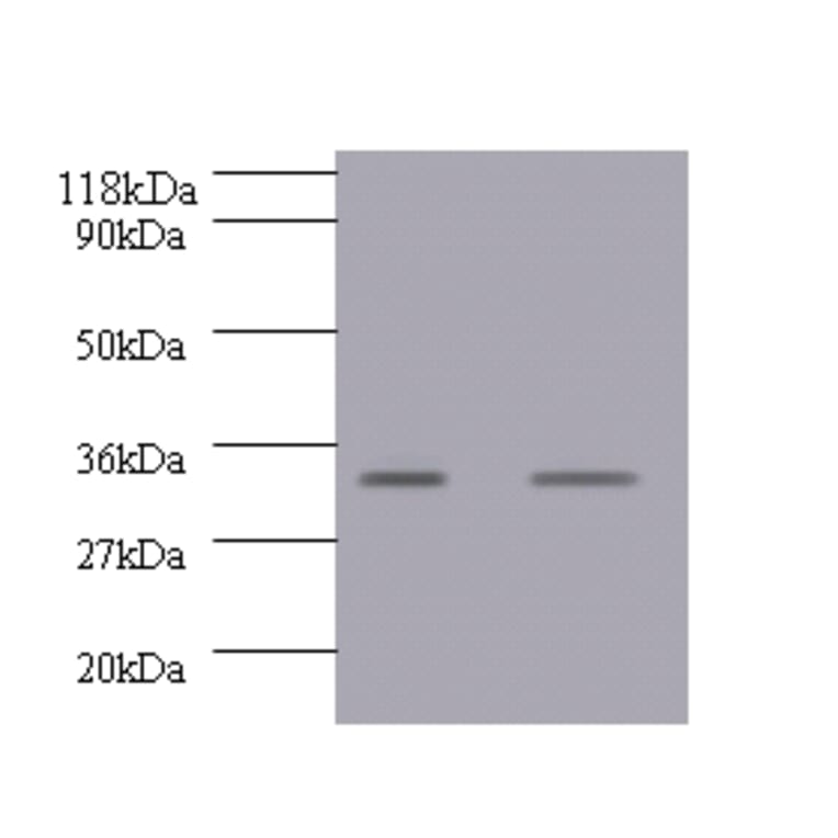 Growth/differentiation factor 15 Polyclonal Antibody from Signalway Antibody (42518) - Antibodies.com