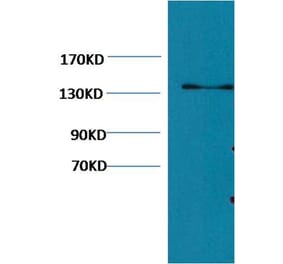 Western blot - Collagen III Mouse Monoclonal Antibody (Q76) from Signalway Antibody (38065) - Antibodies.com