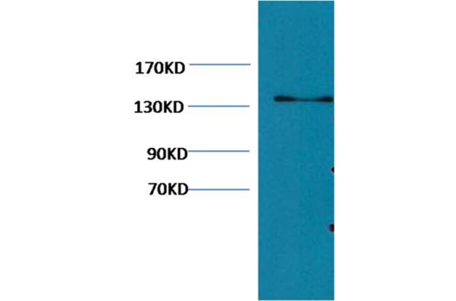 Western blot - Collagen III Mouse Monoclonal Antibody (Q76) from Signalway Antibody (38065) - Antibodies.com