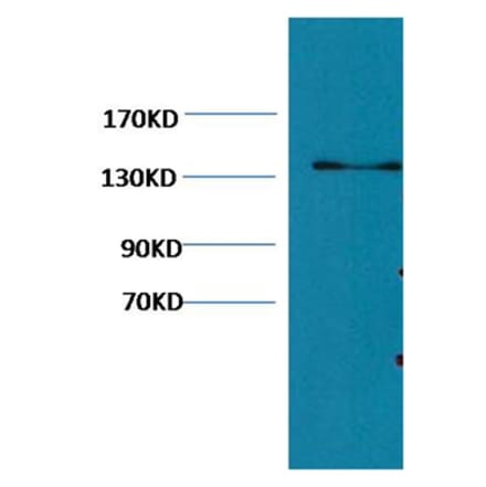 Western blot - Collagen III Mouse Monoclonal Antibody (Q76) from Signalway Antibody (38065) - Antibodies.com