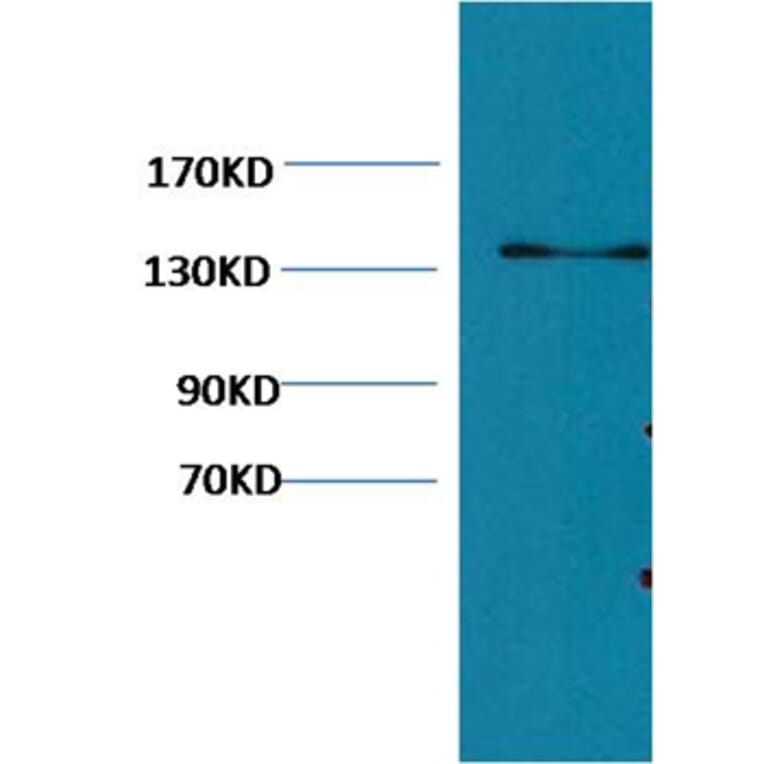 Western blot - Collagen III Mouse Monoclonal Antibody (Q76) from Signalway Antibody (38065) - Antibodies.com
