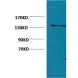 Western blot - Collagen III Mouse Monoclonal Antibody (Q76) from Signalway Antibody (38065) - Antibodies.com