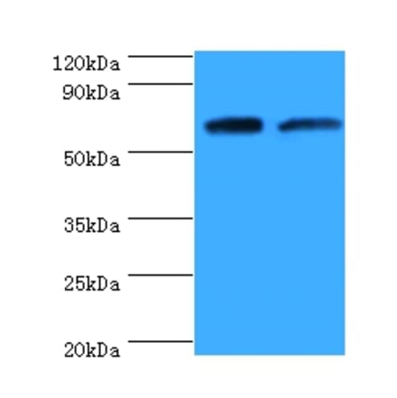 Proactivator polypeptide Polyclonal Antibody from Signalway Antibody (42300) - Antibodies.com