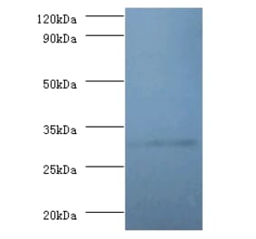 60S ribosomal protein L5 Polyclonal Antibody from Signalway Antibody (42357) - Antibodies.com