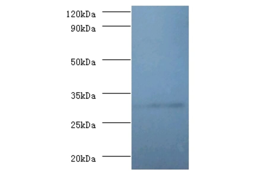 60S ribosomal protein L5 Polyclonal Antibody from Signalway Antibody (42357) - Antibodies.com