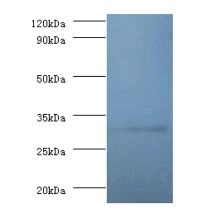 60S ribosomal protein L5 Polyclonal Antibody from Signalway Antibody (42357) - Antibodies.com