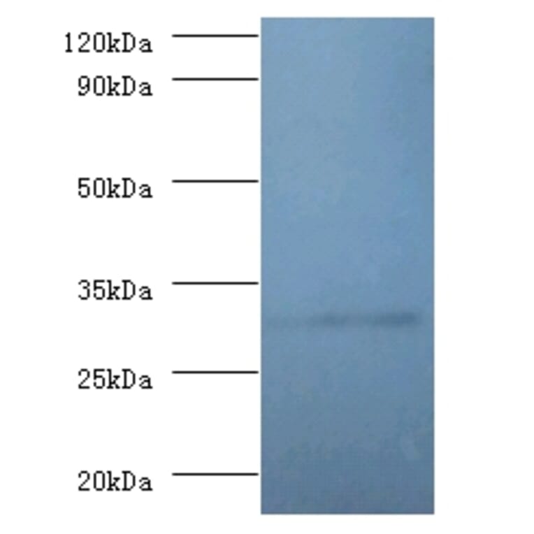 60S ribosomal protein L5 Polyclonal Antibody from Signalway Antibody (42357) - Antibodies.com