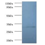 60S ribosomal protein L5 Polyclonal Antibody from Signalway Antibody (42357) - Antibodies.com