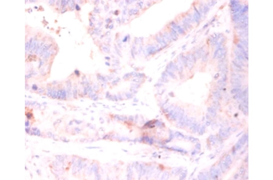 Immunohistochemistry - 60S ribosomal protein L5 Polyclonal Antibody from Signalway Antibody (42357) - Antibodies.com