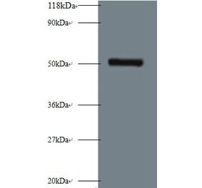 Interstitial collagenase Polyclonal Antibody from Signalway Antibody (42473) - Antibodies.com