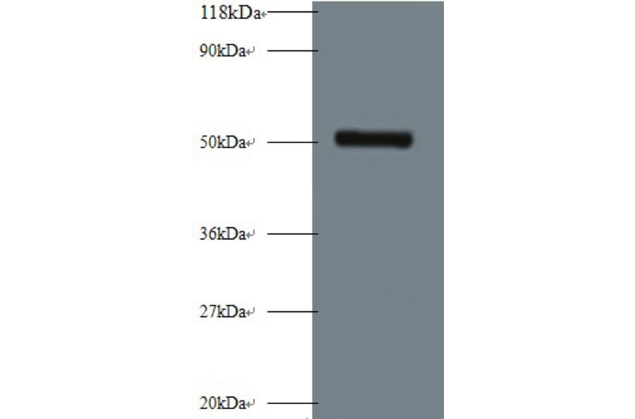 Interstitial collagenase Polyclonal Antibody from Signalway Antibody (42473) - Antibodies.com