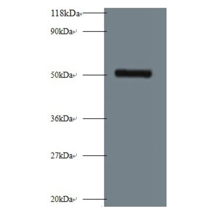 Interstitial collagenase Polyclonal Antibody from Signalway Antibody (42473) - Antibodies.com