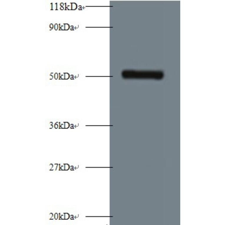 Interstitial collagenase Polyclonal Antibody from Signalway Antibody (42473) - Antibodies.com