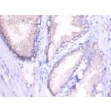Immunohistochemistry - Interstitial collagenase Polyclonal Antibody from Signalway Antibody (42473) - Antibodies.com