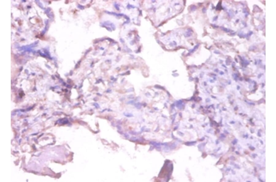 Immunohistochemistry - Interstitial collagenase Polyclonal Antibody from Signalway Antibody (42473) - Antibodies.com