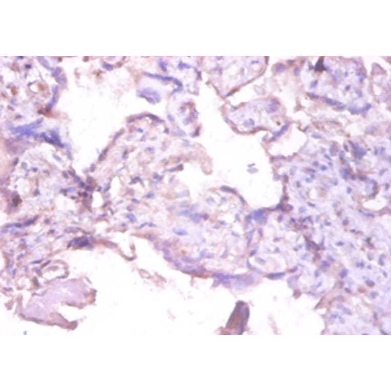 Immunohistochemistry - Interstitial collagenase Polyclonal Antibody from Signalway Antibody (42473) - Antibodies.com