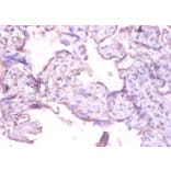 Immunohistochemistry - Interstitial collagenase Polyclonal Antibody from Signalway Antibody (42473) - Antibodies.com
