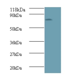 Islet cell autoantigen 1 Polyclonal Antibody from Signalway Antibody (42556) - Antibodies.com