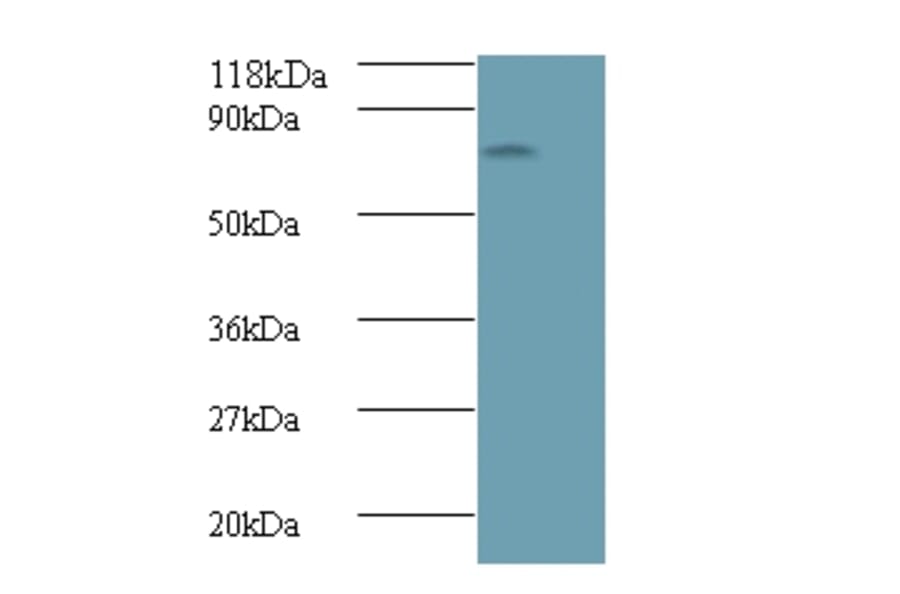 Islet cell autoantigen 1 Polyclonal Antibody from Signalway Antibody (42556) - Antibodies.com