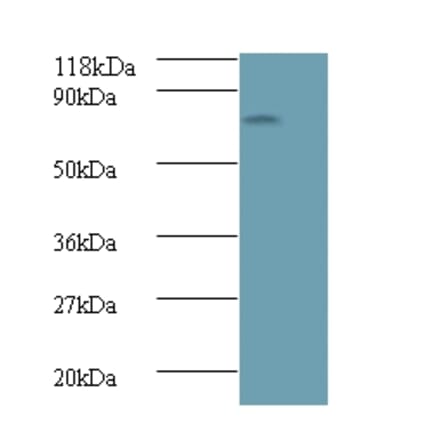 Islet cell autoantigen 1 Polyclonal Antibody from Signalway Antibody (42556) - Antibodies.com