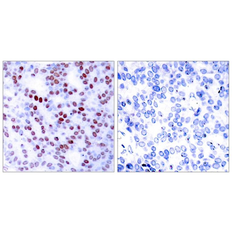 Immunohistochemistry - c-Jun (Ab-243) Antibody from Signalway Antibody (21025) - Antibodies.com